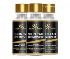 Silky Skin Tag Remover Surveys: Serum, Uses and Work?