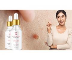 Amarose Skin Tag Remover - Does It Truly Work For Sound Skin?
