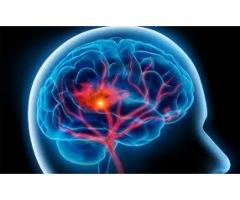 How Neuro Brain Is A Good Pill For Your Brain?