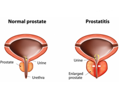 Gorilla Flow Prostate Health Reviews, Benefits and Side impacts!